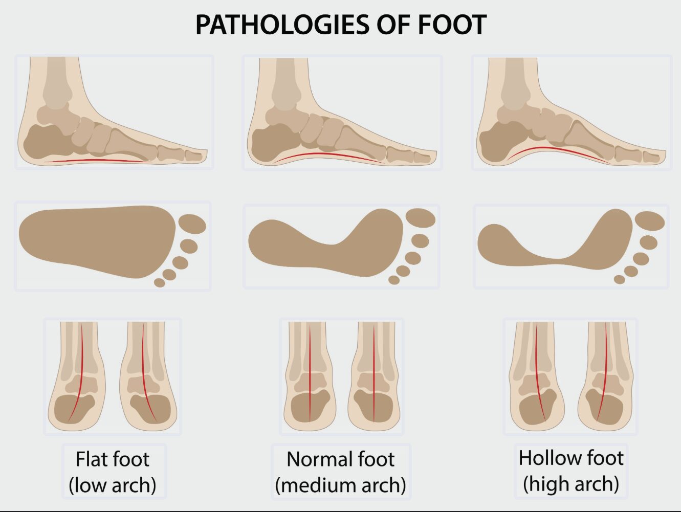 ローファー 横幅 きつい