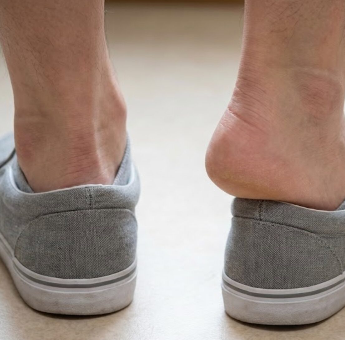 スケッチャーズ スリップ インズ 脱げる